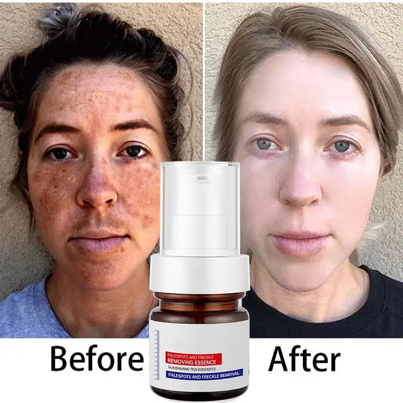 2-⚡️5-second brightening！Vitamin C Whitening Freckles Essence
