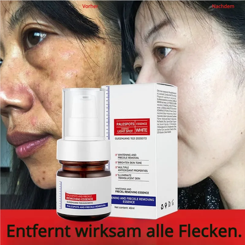 5-Sekunden-Aufhellung! Vitamin C-Aufhellungsessenz gegen Pigmentflecken