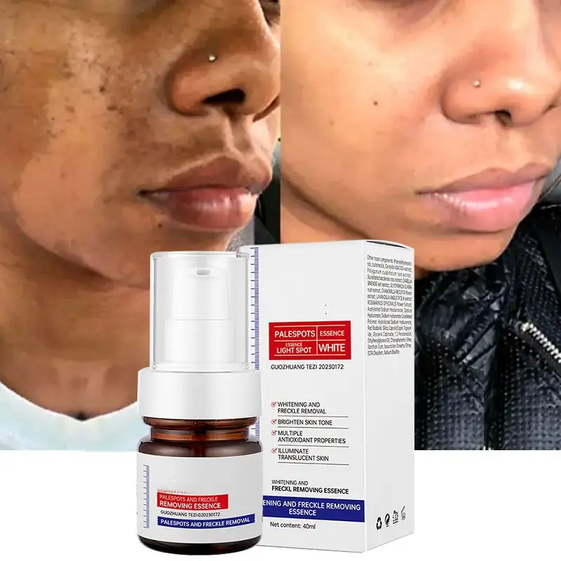 2-⚡️5-second brightening！Vitamin C Whitening Freckles Essence