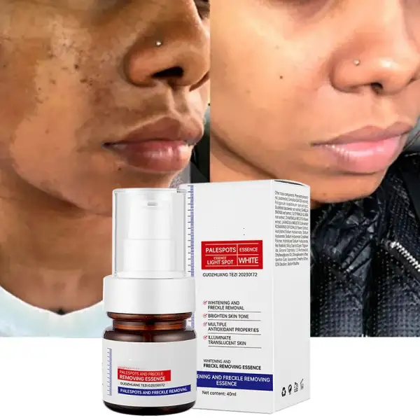 5-second brightening！Vitamin C Whitening Freckles Essence