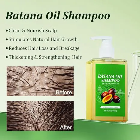 Batana Oil Shampoo,Rosemary Shampoo,Nourishing & Rejuvenating for Softness & Volume, Suitable for Men & Women, Reduces Hair Loss (10.14 fl oz)