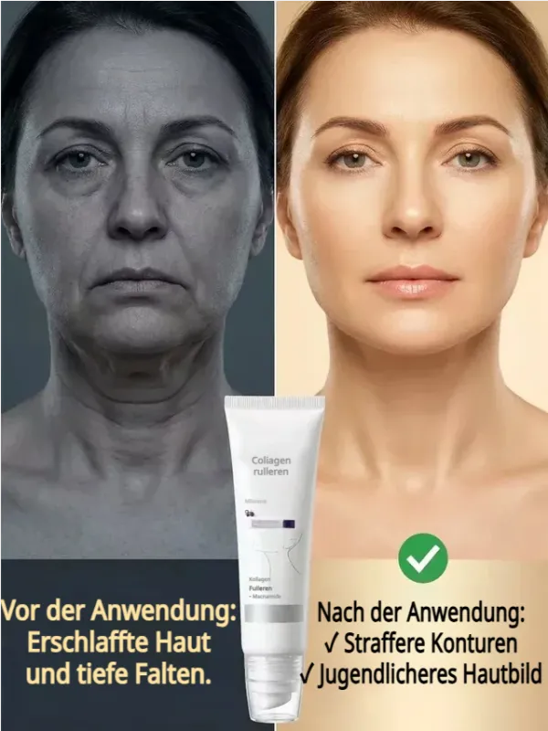 🔥 BIG SALE – 50 % RABATT ✨ Roller-Anti-Aging-Liftcreme – Heben Sie Ihre Halspflege auf ein neues Niveau