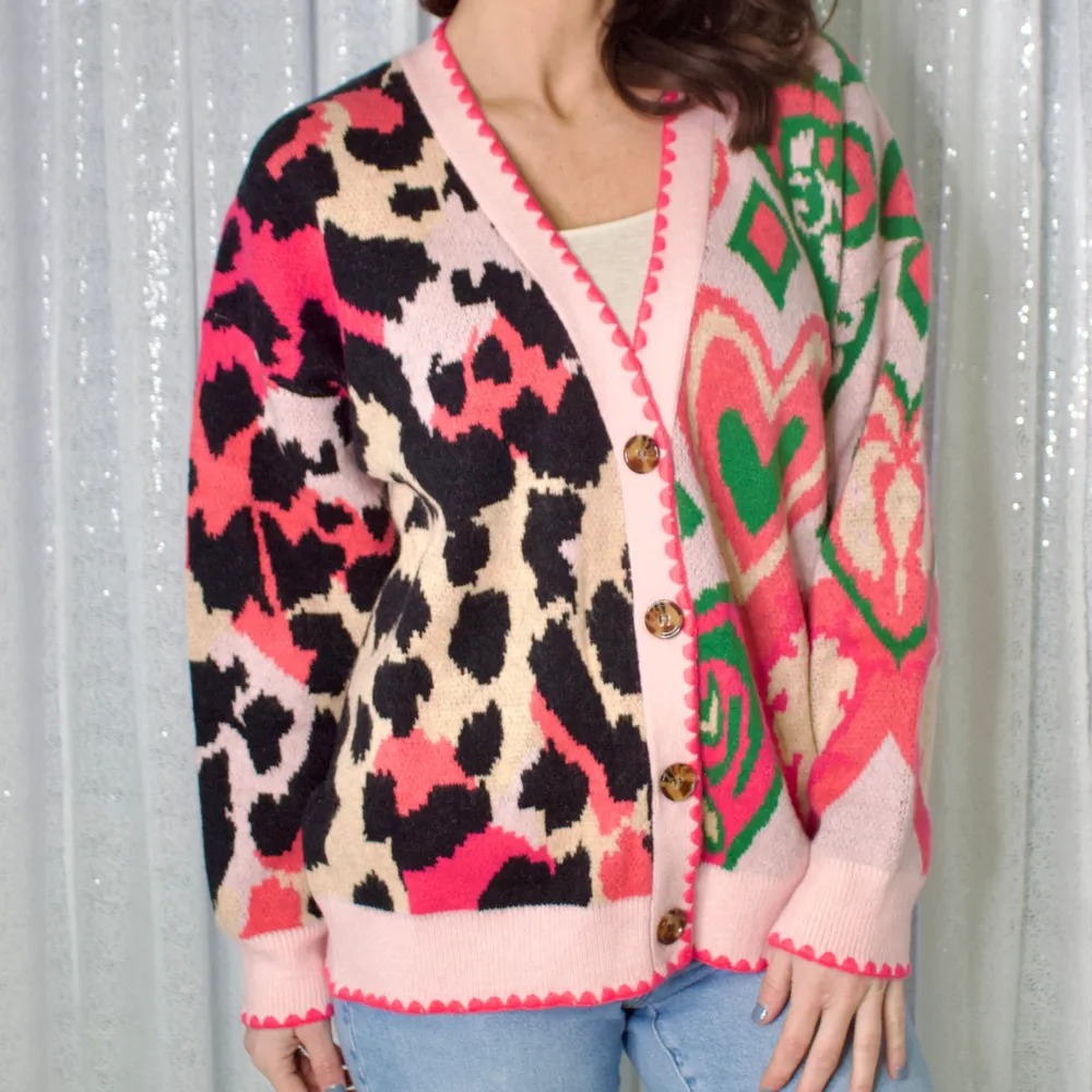 Chunky Knit Ribbed Scalloped Edge Oversized Cardigan