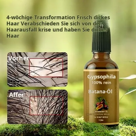 Batana-Öl für Haarwachstum – 100 % reines natürliches Haaröl. Es pflegt die Kopfhaut, beseitigt Spliss, mindert Haarausfall und entgiftet die Kopfhaut (30 ml), geeignet für alle Haartypen.