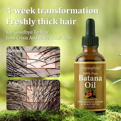 Batana Oil for Hair Growth -100% Pure Natural Hair Growth Oil,Nourishes The Scalp, Eliminates Split Ends, Reduce Hair Loss & Detox Your Scalp (1 Fl Oz) for All Hair Types
