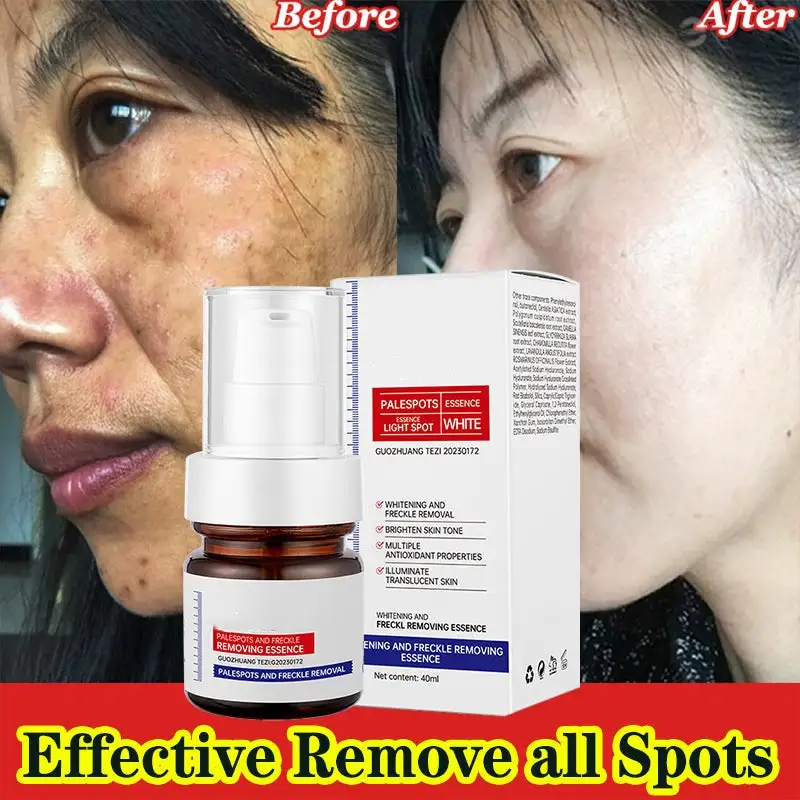 2-⚡️5-second brightening！Vitamin C Whitening Freckles Essence