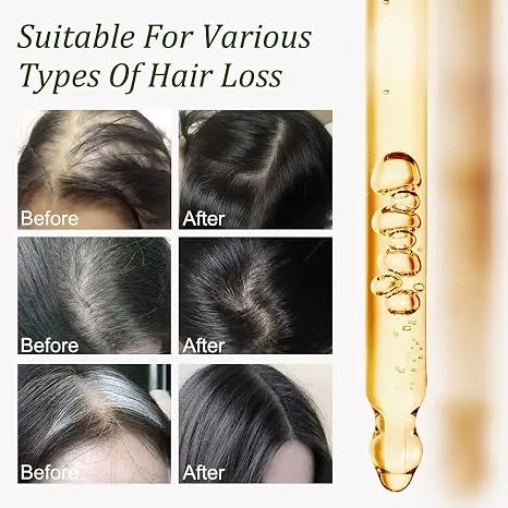 Batana Oil for Hair Growth -100% Pure Natural Hair Growth Oil,Nourishes The Scalp, Eliminates Split Ends, Reduce Hair Loss & Detox Your Scalp (1 Fl Oz) for All Hair Types