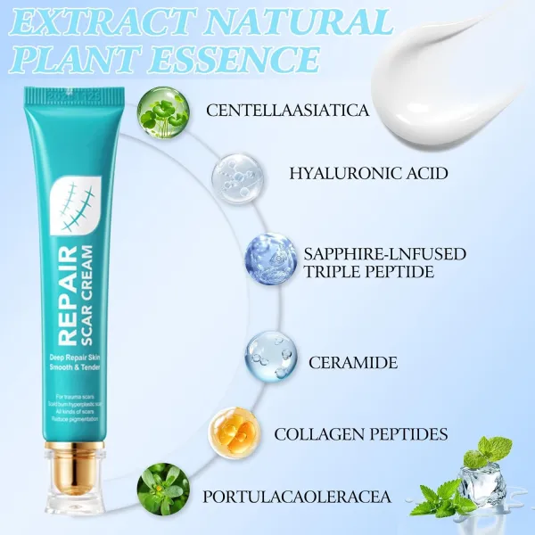 ✨BIG SALE-49% OFF🔥Scar Repair Cream🌿|Treats Old and New Scars, Burns and More