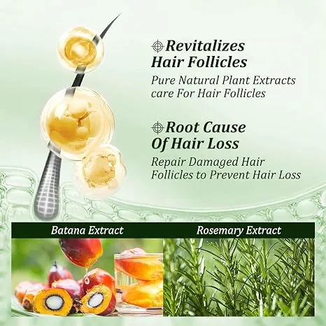 Batana Oil Shampoo,Rosemary Shampoo,Nourishing & Rejuvenating for Softness & Volume, Suitable for Men & Women, Reduces Hair Loss (10.14 fl oz)
