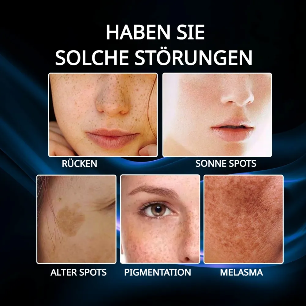5-Sekunden-Aufhellung! Vitamin C-Aufhellungsessenz gegen Pigmentflecken