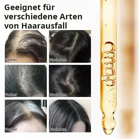 Batana-Öl für Haarwachstum – 100 % reines natürliches Haaröl. Es pflegt die Kopfhaut, beseitigt Spliss, mindert Haarausfall und entgiftet die Kopfhaut (30 ml), geeignet für alle Haartypen.